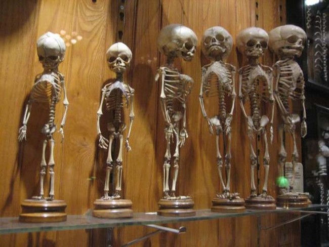 Collection of children's skeletons.