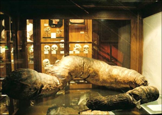This nine-foot-long human colon is one of the most popular attractions at the M&uuml;tter Museum.