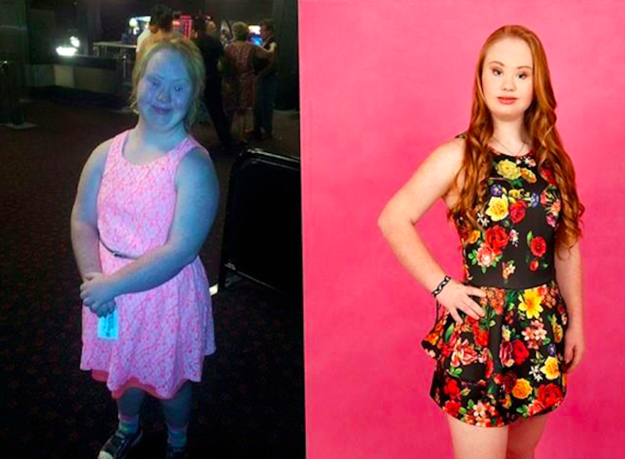 Maddy, who struggled with her weight growing up, recently lost 40 lbs. thanks to dance, cheerleading, and swimming.