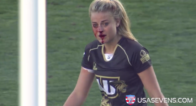 USA Sevens Rugby shared a video of Page with blood pouring down her face, and dubbed her the "Rugby War Goddess." The video soon blew up online.