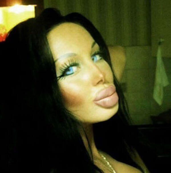 plastic surgery gone wrong 26