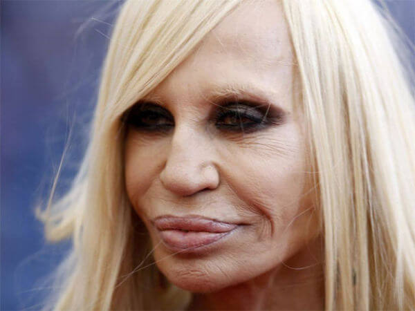 plastic surgery gone wrong 10