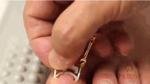 This Video Of Someone Fixing An Ingrown Toenail Is Grossly Mesmerizing
