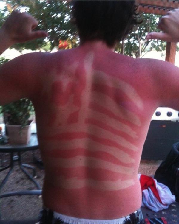 fb6dfd26616a36e3c5789319f972e9d1 A friendly (and painful) reminder to wear sunscreen this weekend! (28 Photos)