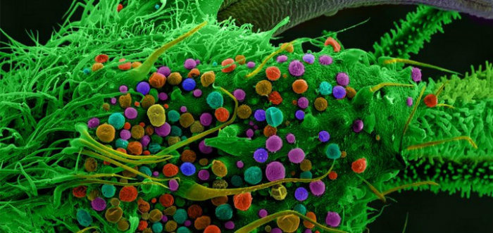 The flowering part of a cannabis plant under a microscope.