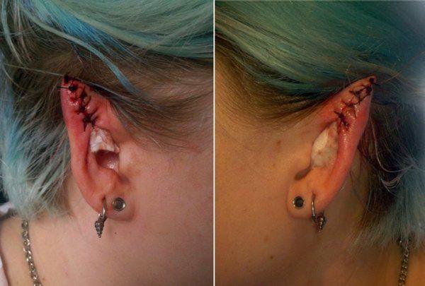 people with bizarre body modifications 9 These people must really hate their parents (21 Photos)