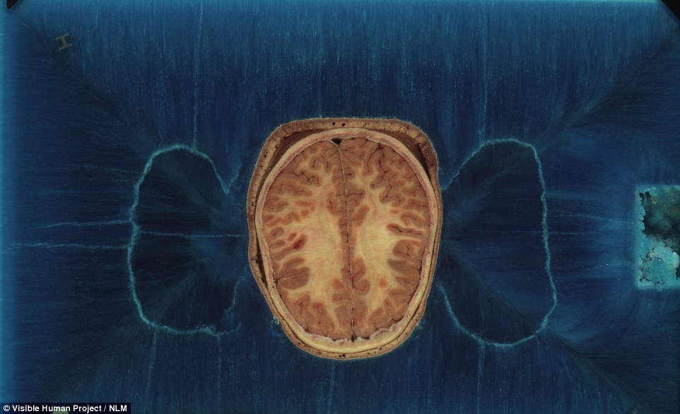 Scientists are using the data to study human anatomy in greater detail than was previously possible but it is also allowing them to recreate the human body online so they can conduct experiments that would not be allowed on living humans. A cross section of the woman's head, showing her brain inside, is shown above