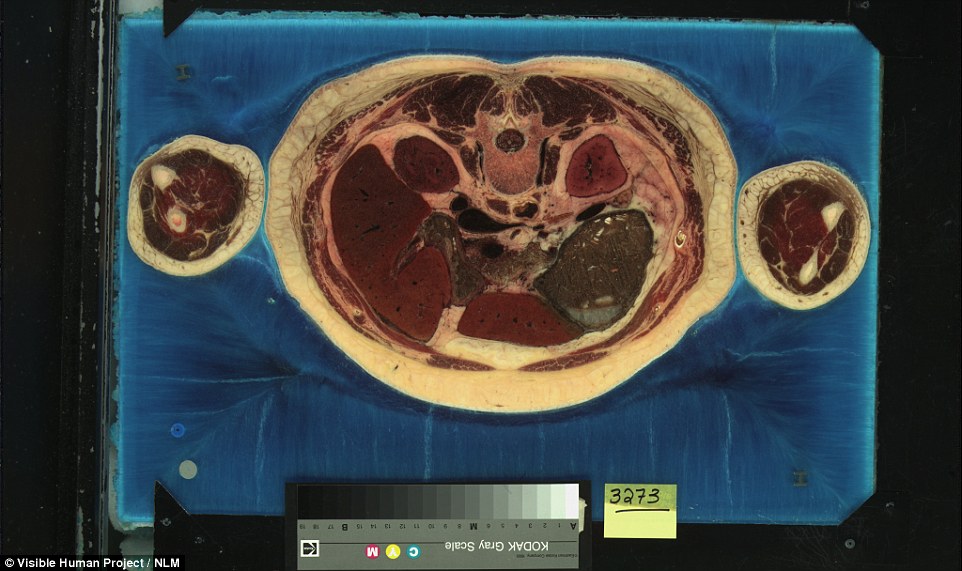 The cross sections show the position of the internal organs including the liver, lungs, heart, bladder and kidneys, but also show how other tissues like muscle and fat are organised through out the human body, like in this cross section above