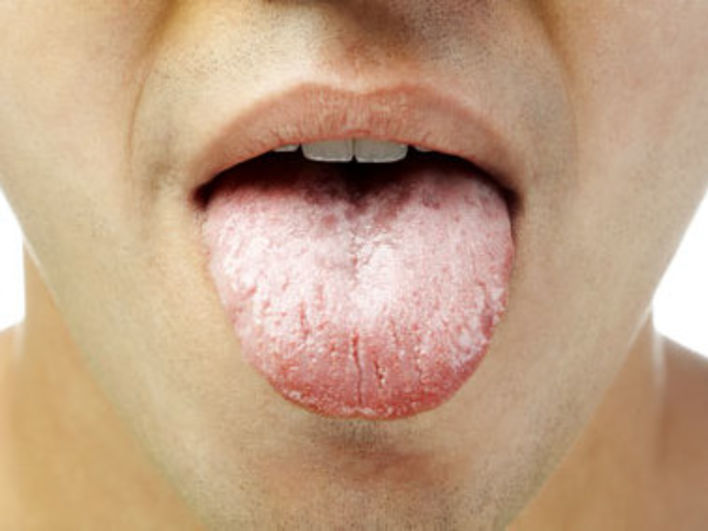 tongue3