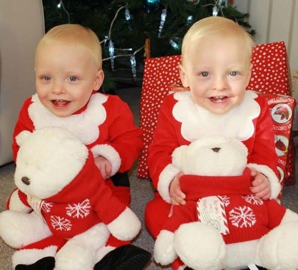 Mirror-image twins are rare, affecting up to a quarter of all identical twins. 10 days after conception, Lucas and Louie divided into two. Had they split just a day later, they would have been conjoined. 