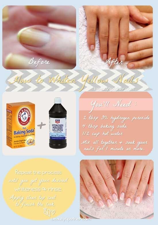 If you don&#39;t want to bother getting a full manicure (and who does?) you can simply clean up your nails with this simple recipe