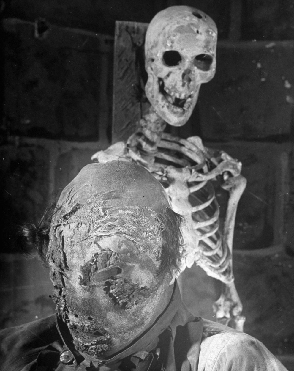 The faceless victim of an acid bath, circa 1905.