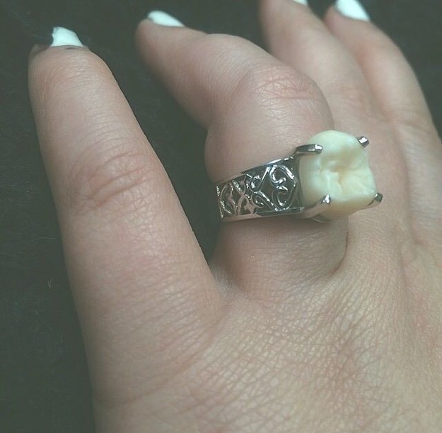 After his dad mailed them one of the wisdom teeth Unger had removed when he was younger, they took the tooth to a jeweler to see if he could come up with something unique.