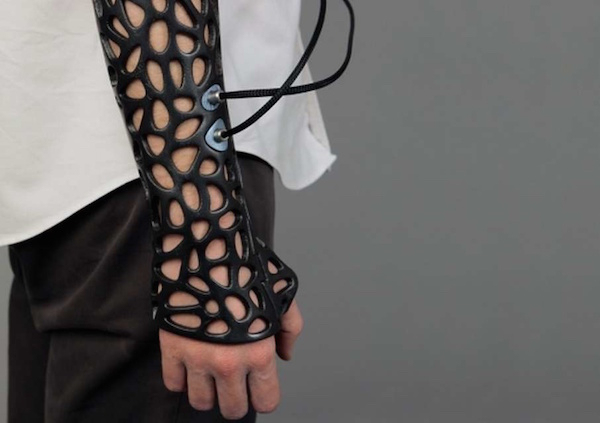 A 3D cast with ultrasound technology, which helps heal bones faster.