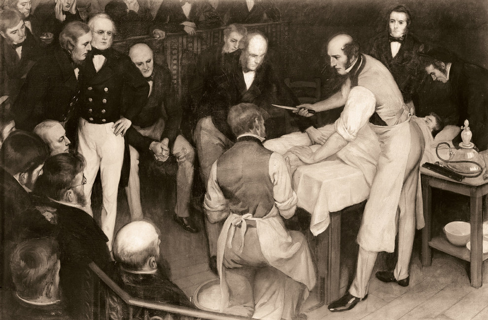 A painting depicting one of the first British operations carried out with anaesthesia by pioneering Scottish surgeon Robert Liston. He operated with a knife gripped between his teeth, and could amputate a leg in under three minutes.