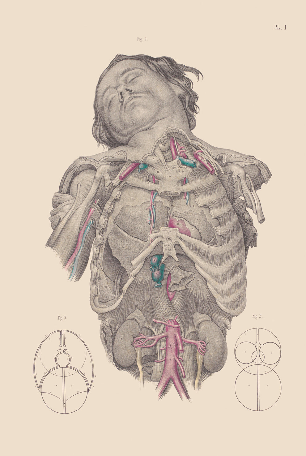 Dissection of the thorax, showing the relative positions of the lungs, heart, and primary blood vessels.