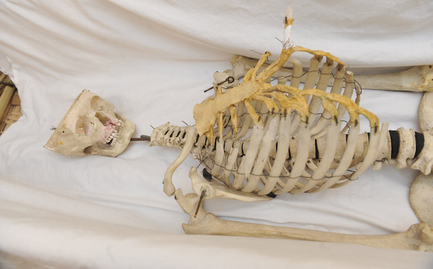 You know those skeletons that schools use to teach kids about anatomy? For 50 years, teachers and staff at one school had no idea that theirs used to belong to a real person.