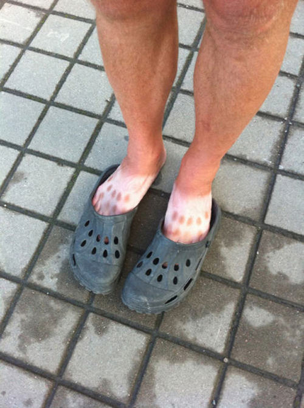 This person who wore these Crocs for this long.