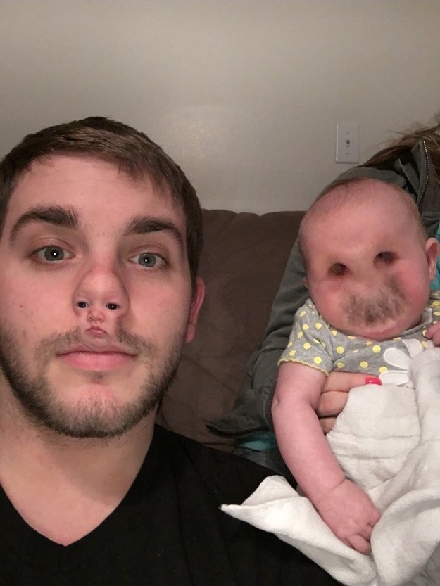 A picture of a father and daughter – ruined by this horrifying filter that just wants to see the world burn.