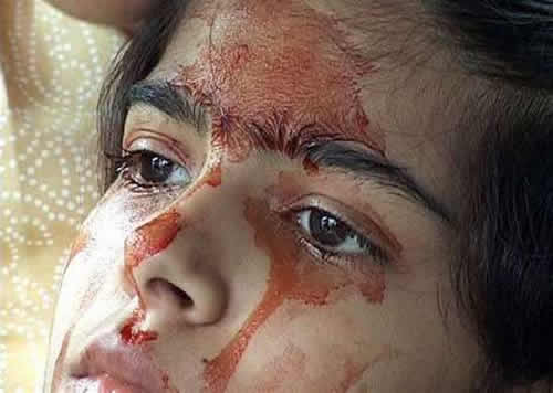 這名可憐少女眼睛耳朵每天都會莫名流血，但醫生專家檢查後發現的結果讓人真的無法接受！