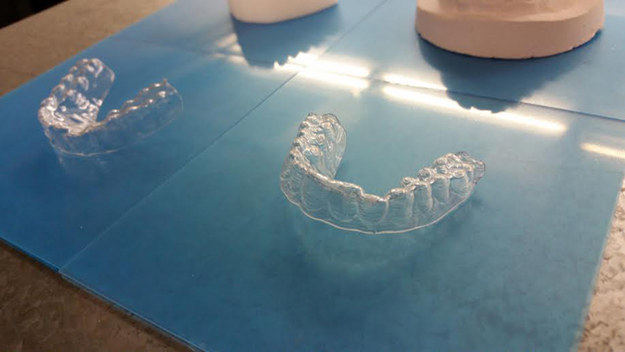 After a ton of research, Dudley created his own set of 12 plastic braces. He documented the whole process on his blog, and noted he made the braces as part of a portfolio project for school.