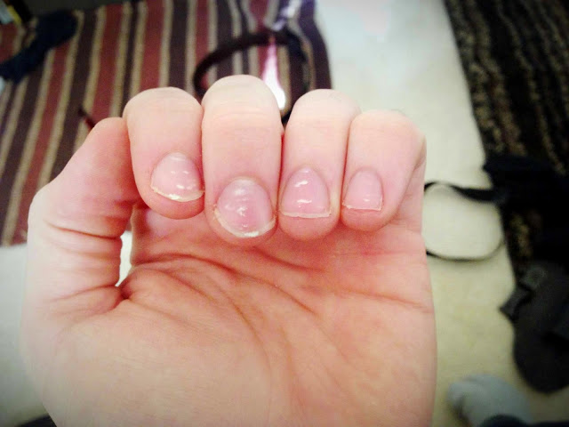 fingernails-1