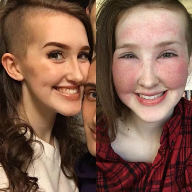 Here's what happens when makeup makes your face swell up.