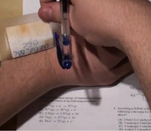 Sneaky! One cunning exam sitter used a fake injury to conceal answers
