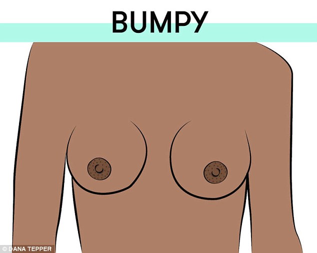 Sometimes small bumps surround the nipple. They can look like white heads but don't play with them