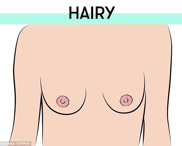 Dark hairs growing out of the areola are perfectly normal. They can be fine or coarse but all women have them