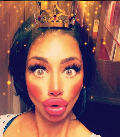 Alia Byrne, 30, from Liverpool who has had a massive amount of filler injected into her lips