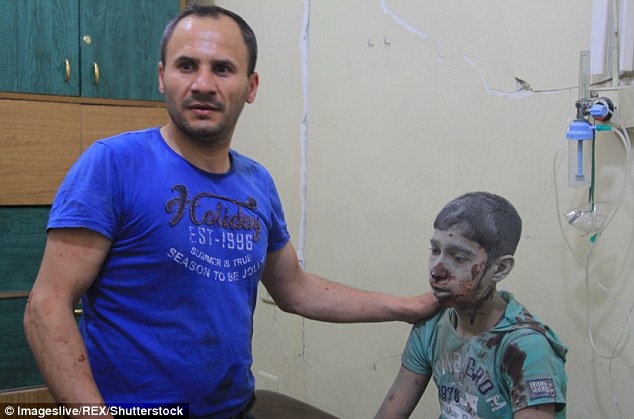 A young boy, covered in blood and dust, awaits treatment in Aleppo 