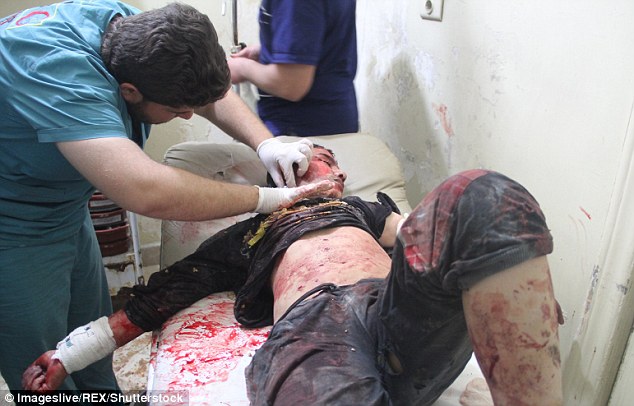 A doctor sees to an injured young man in Aleppo after the rocket attack