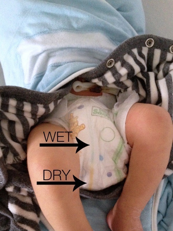Find out if your baby is wet or poopy — without opening their diaper — by checking their diaper’s color line.