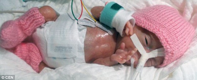 She measured just 22cm and weighed 8 ounces when she was born prematurely last year