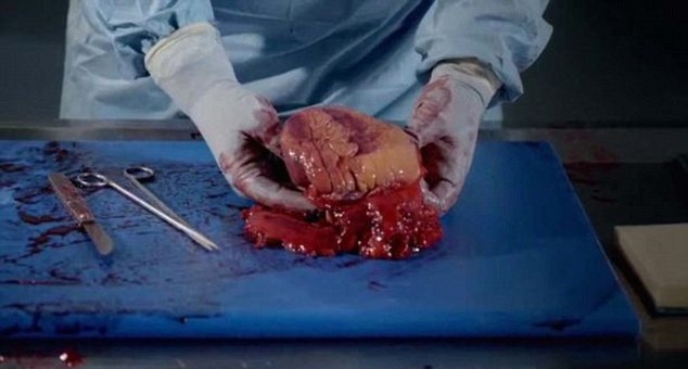 驗屍官「解剖百公斤女子」帶你目睹肥胖背後的恐怖真相，看到「形容切開脂肪的感覺」瞬間頭皮發麻…(血腥慎入)