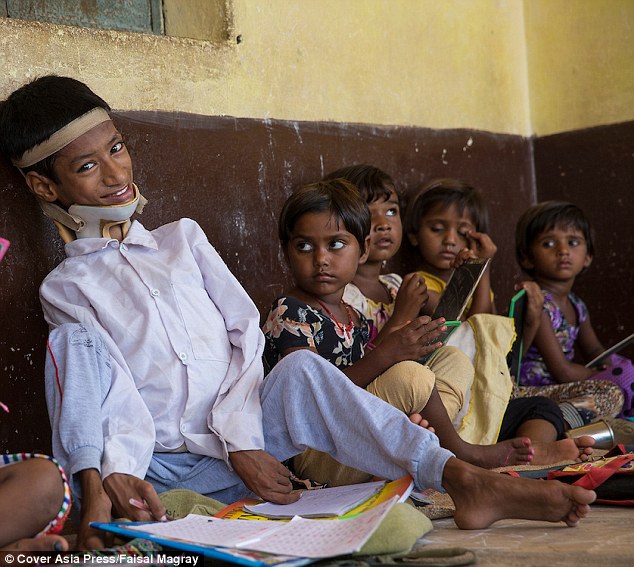 Before the operation Mahendra, pictured, was unable to go to school. He was restricted to sitting as he was unable to stand or walk and needed help to eat and go to the toilet.