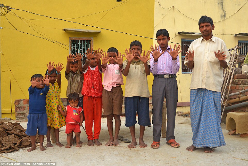 Hands up: This extraordinary Indian family has 600 digits between them - with each of the 25 members boasting 12 fingers and 12 toes