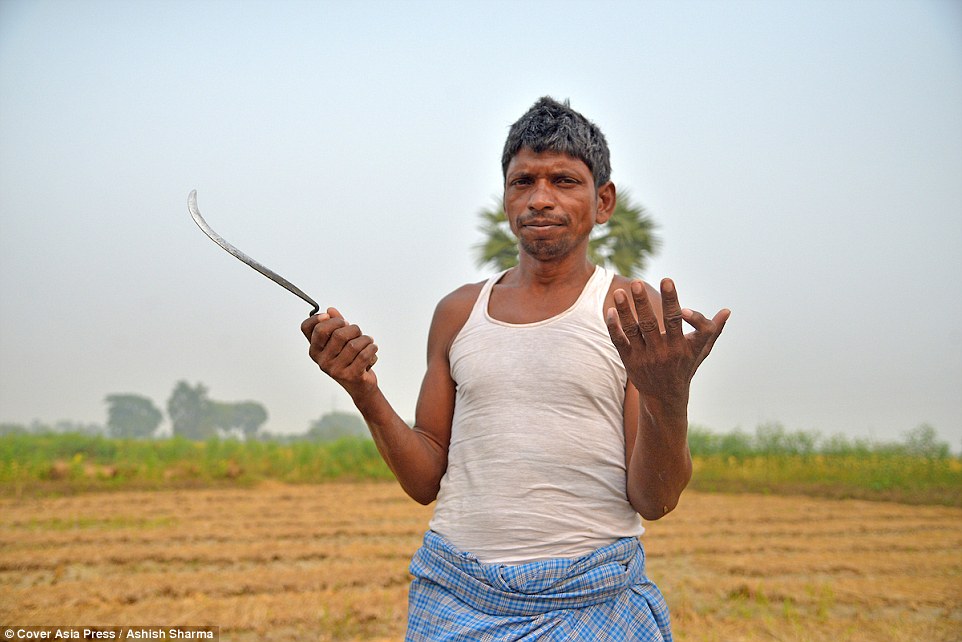 Krishna Choudhary, 50, a daily wage labourer, shows his 12 fingers at his farm land in Teusa village in Bihar, India