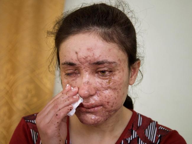 18岁的她只因信仰不同「沦ISIS性奴」每天被轮暴，爆炸中逃脱只为告诉世人「我们在受苦」！