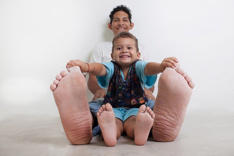 Who has the biggest feet in the world?