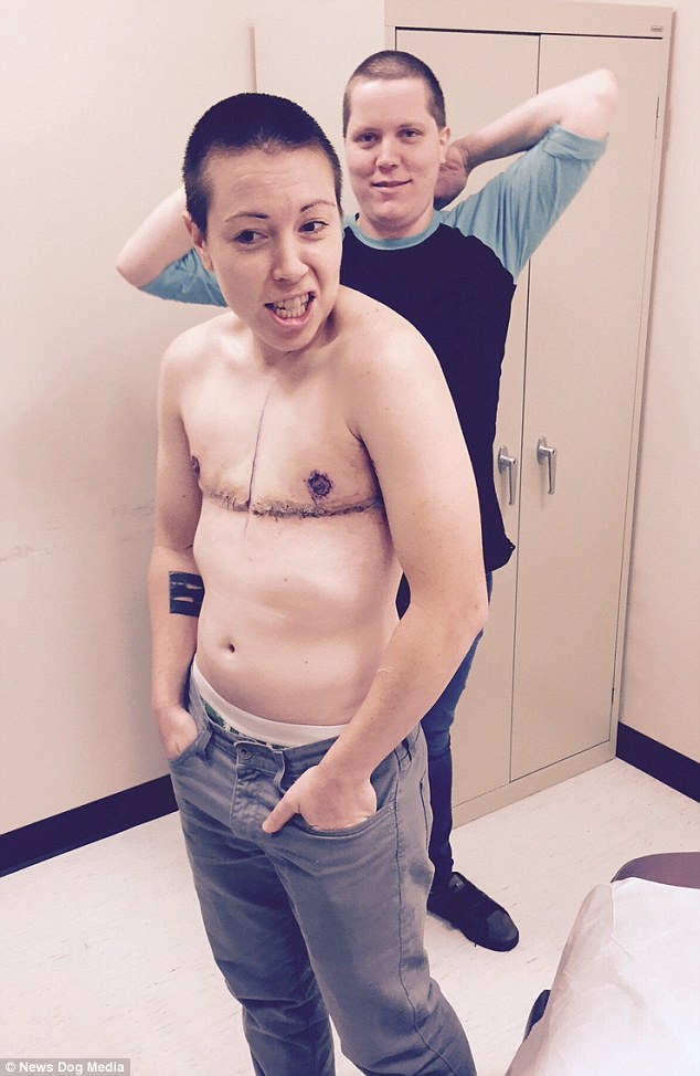After coming out as transgender in 2012 to his family and friends, Cody went on to have a mastectomy (pictured here after surgery) and began taking male hormones