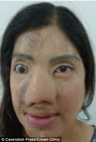 She is now planning fresh surgery on her nose, and has got married
