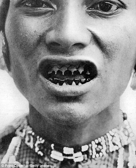 A member of the Bagobo people from coastal Mindanao in the Philippines displays filed teeth in a photo taken circa 1910
