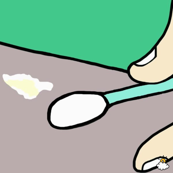 Earwax Type #4: White, Dry, And Flaky 
