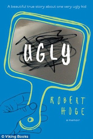 Author: Robert has written a memoir of his experiences, called Ugly, pictured