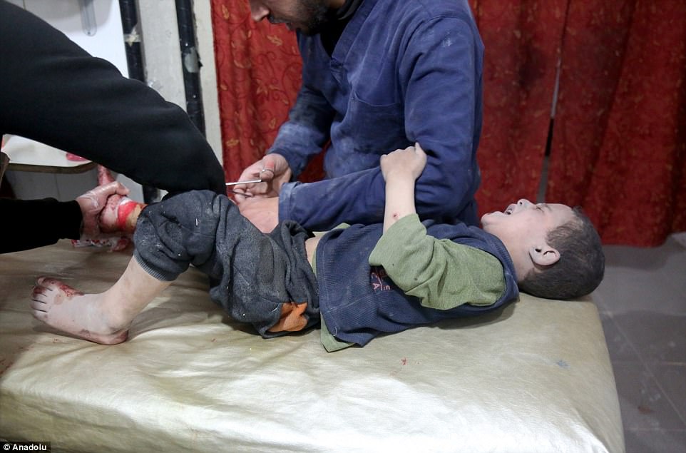 Air strikes hit Douma, Kafr Batna and Saqba, a town in the Eastern Ghouta Region of Damascus, Syria, on Tuesday and Wednesday. Pictured above, a young boy receives medical treatment after attacks in the Kafr Batna district of Eastern Ghouta in Damascus on Tuesday