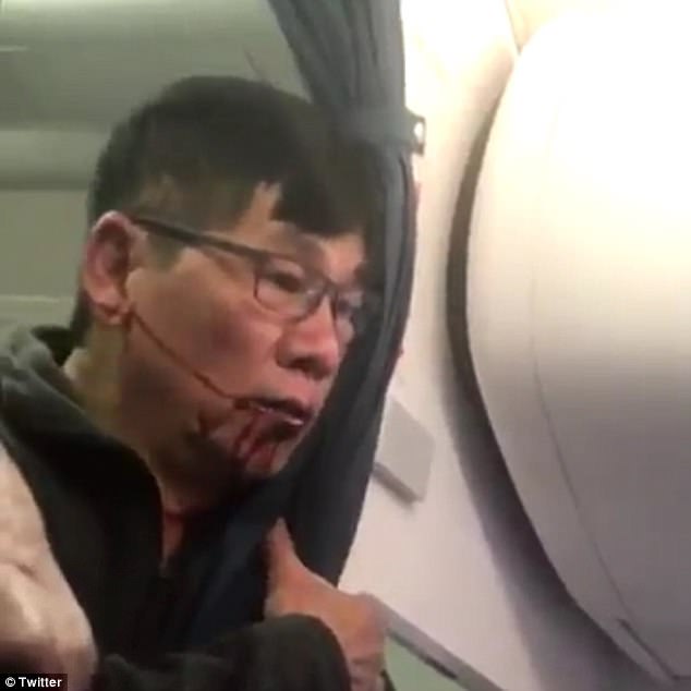 Beaten and bloodied: The unnamed passenger is pictured bleeding from the mouth after he was body slammed by cops and dragged off the overbooked United flight at Chicago O'Hare