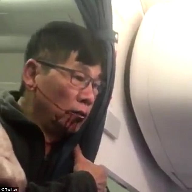 Dr David Dao is pictured bleeding from the mouth after he was body slammed by cops and dragged off the overbooked United flight at Chicago O'Hare