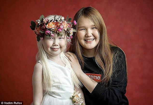 The Siberian 'Snow White' is seen with her sister Karina, 14, who has dark hair and features